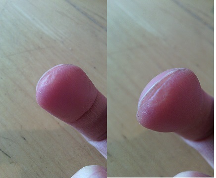 finger.jpg